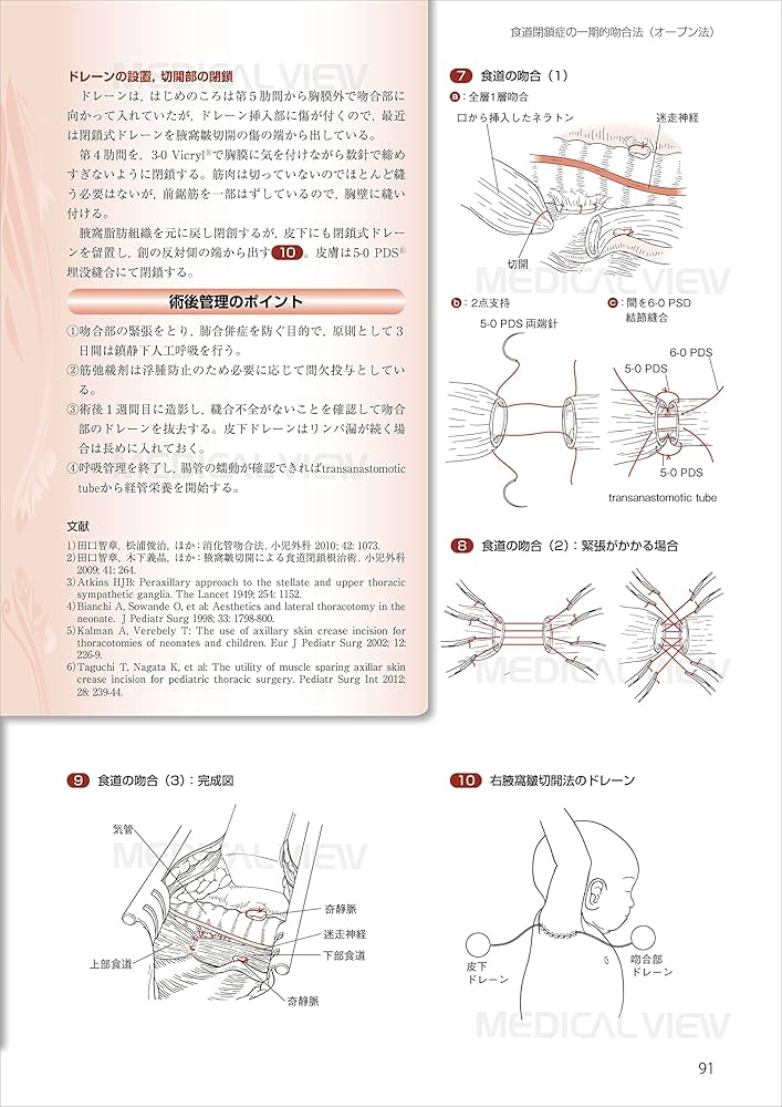 スタンダード小児外科手術 | 猪股 裕紀洋 |本 | 通販 | Amazon
