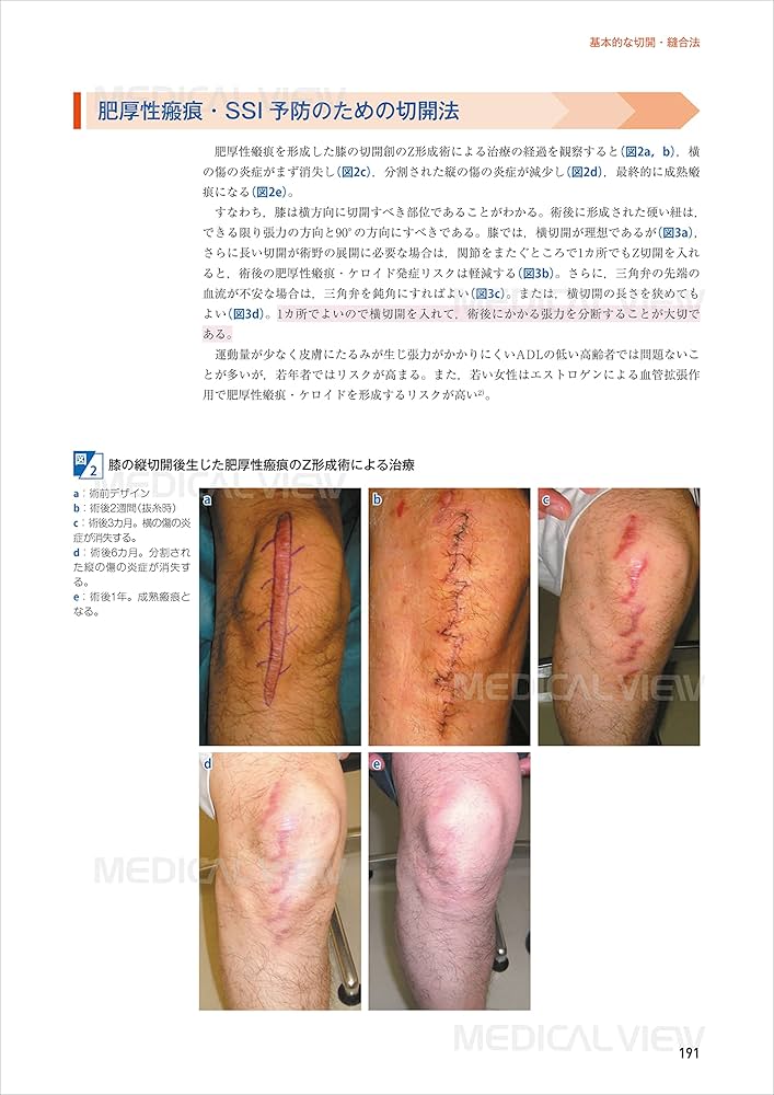 膝関節の再建手術 (新OS NEXUS No.1) | 松田 秀一 |本 | 通販 | Amazon