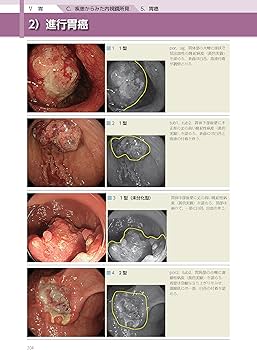 消化管内視鏡診断テキスト I 食道・胃・十二指腸 第5版 (消化器画像