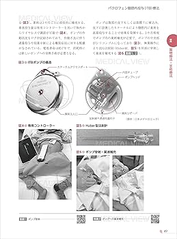 脳性麻痺 運動器治療マニュアル | 粟國 敦男, 金城 健 |本 | 通販 | Amazon