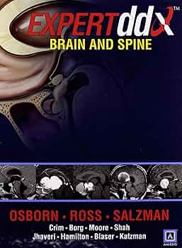 Amazon | EXPERTddx™: Brain and Spine (Expert Differential