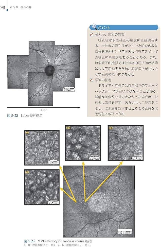 Amazon.co.jp: 視能検査学 (視能学エキスパート) : 公益社団法人 日本