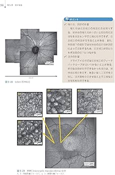 Amazon.co.jp: 視能検査学 (視能学エキスパート) : 公益社団法人 日本