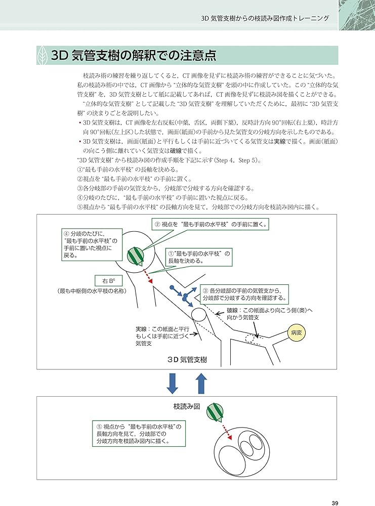 末梢病変を捉える 気管支鏡“枝読み”術 [DVD-ROM(Windows版)付] 第2版