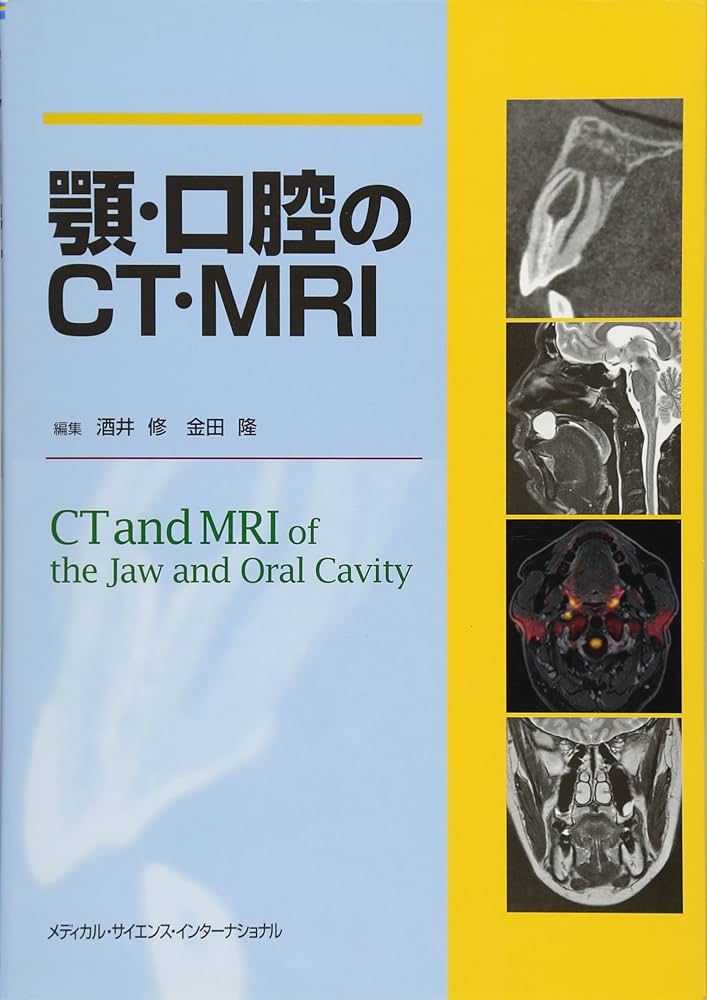 顎・口腔のCT・MRI | 酒井 修, 金田 隆 |本 | 通販 | Amazon