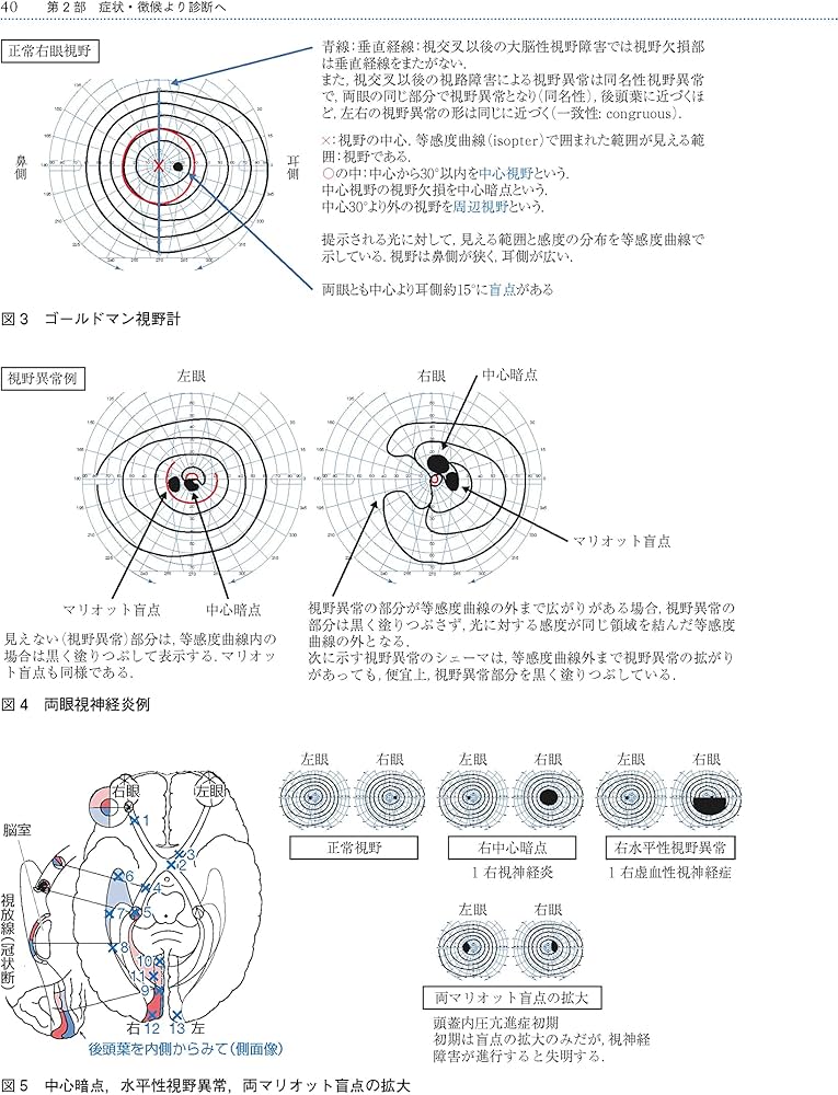 Amazon.co.jp: 神経眼科 第4版: 臨床のために : 江本 博文, 清澤 源弘