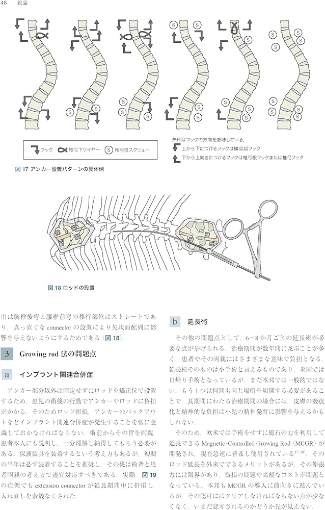 Amazon.co.jp: 症例から学ぶ小児脊柱変形（基礎から難治性疾患まで