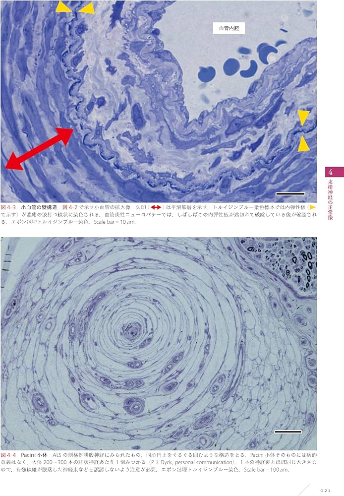 末梢神経病理：どう作り、どう読み、どう臨床に生かすか | 神田隆