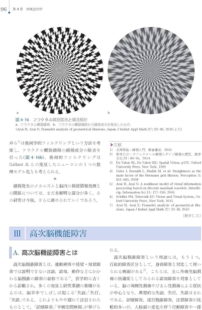 Amazon.co.jp: 視能訓練学 (視能学エキスパート) : 公益社団法人 日本