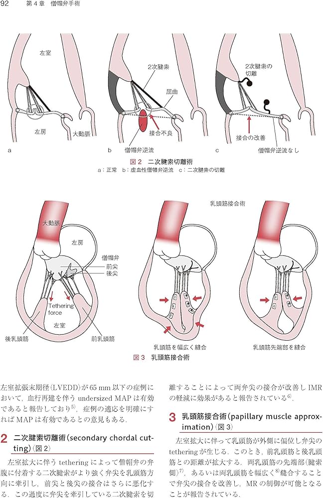 心臓・大動脈外科手術 基本・コツ・勘所 心臓・大動脈外科手術: 基本