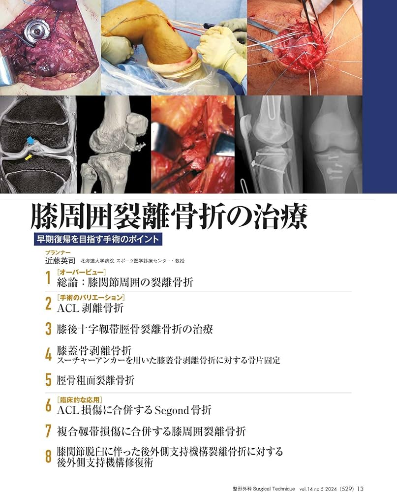 Amazon.co.jp: 整形外科サージカルテクニック 2024年5号〈特集〉膝周囲