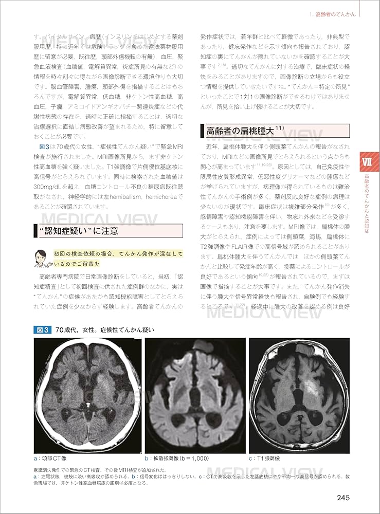 画像で究める認知症 | 德丸 阿耶 |本 | 通販 | Amazon