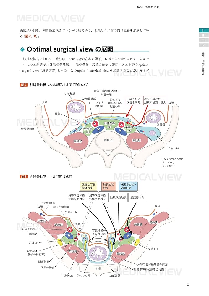 究める鏡視下膀胱全摘術・尿路変向術 Level up LRC, RARC | 三木 淳