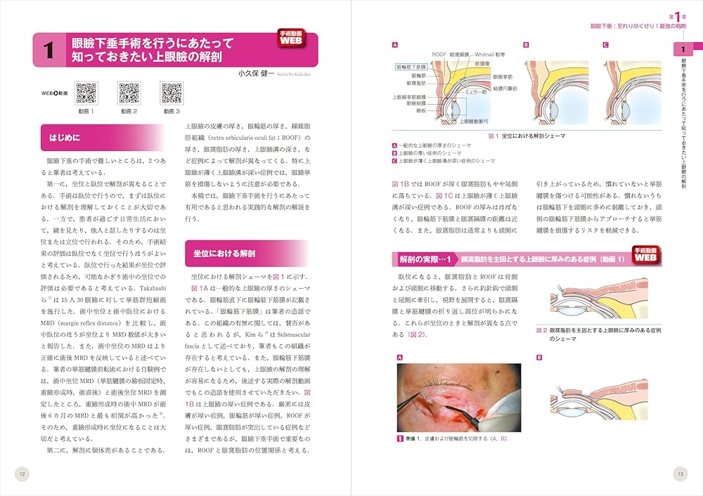 動画＆イラスト＆写真でわかる眼瞼手術の極意 advance：誰でも