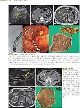 肝胆膵 (非腫瘍性疾患病理アトラス) | 原田 憲一, 能登原 憲司 |本