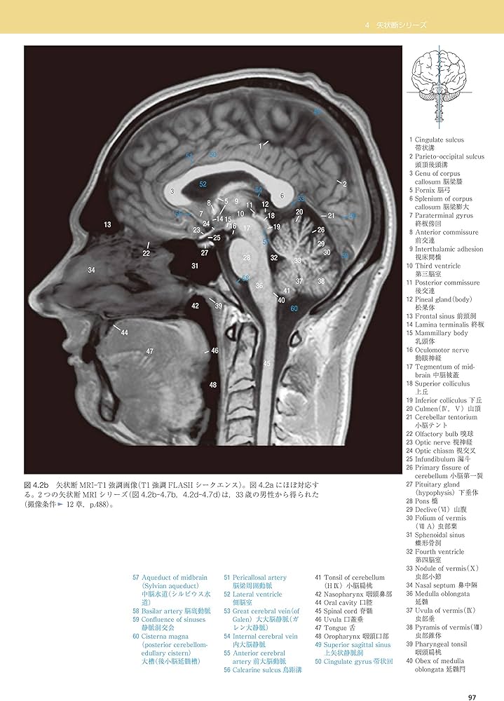 脳の機能解剖と画像診断 第2版 | 眞柳 佳昭 |本 | 通販 | Amazon