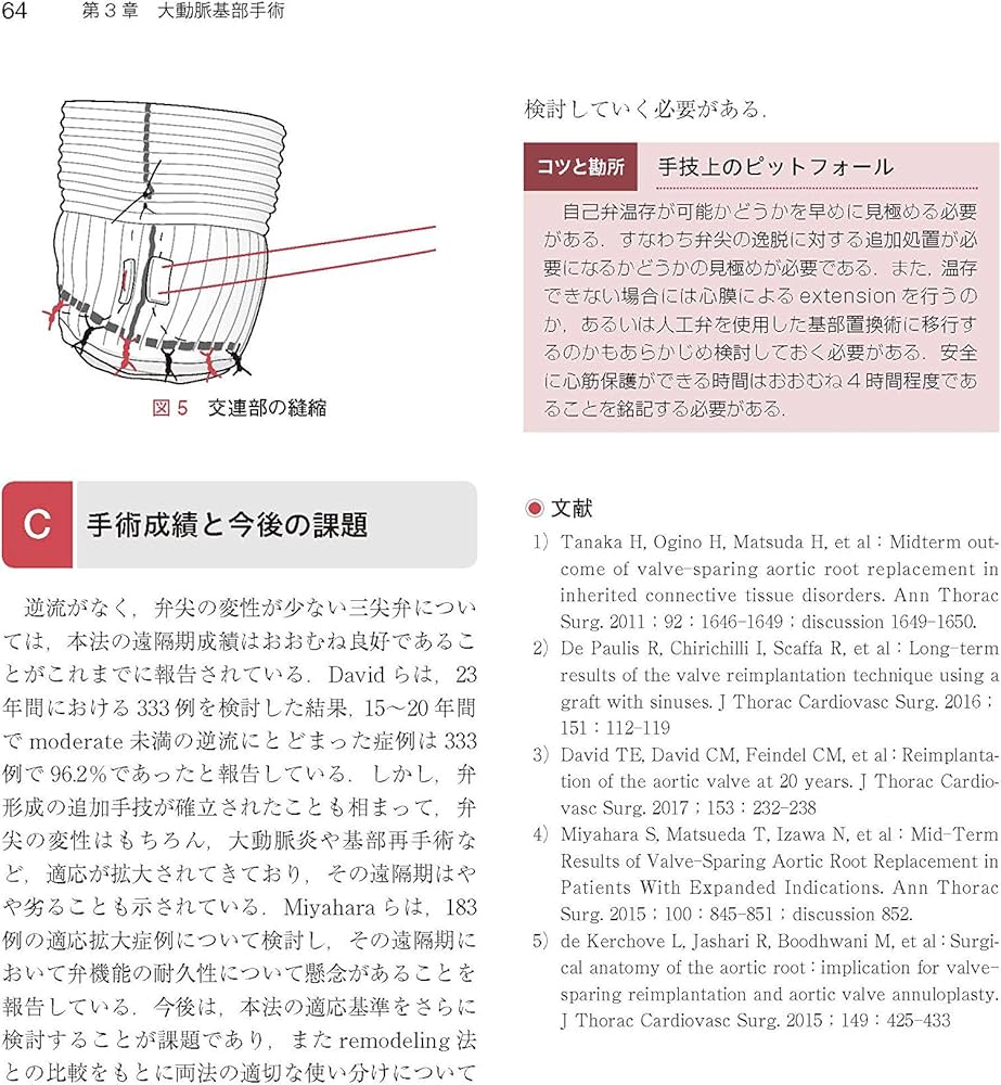 心臓・大動脈外科手術: 基本・コツ・勘所 | 小坂 眞一 |本 | 通販 | Amazon