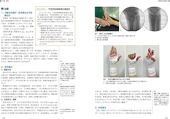 整形外科の外傷処置 捻挫・打撲・脱臼・骨折 (ニュースタンダード整形