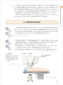 上肢 (新 執刀医のためのサージカルテクニック) | 長尾 聡哉 |本