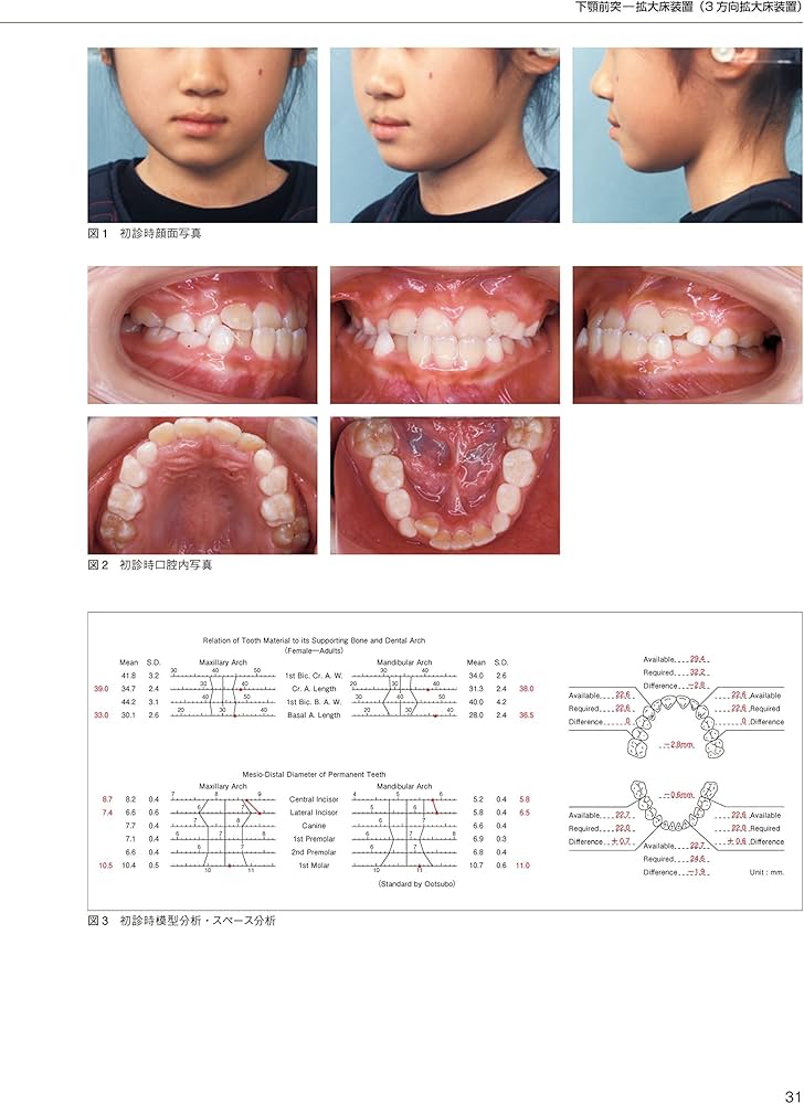 矯正歯科治療 この症例にこの装置 第2版 | 後藤 滋巳, 清水 典佳, 槇