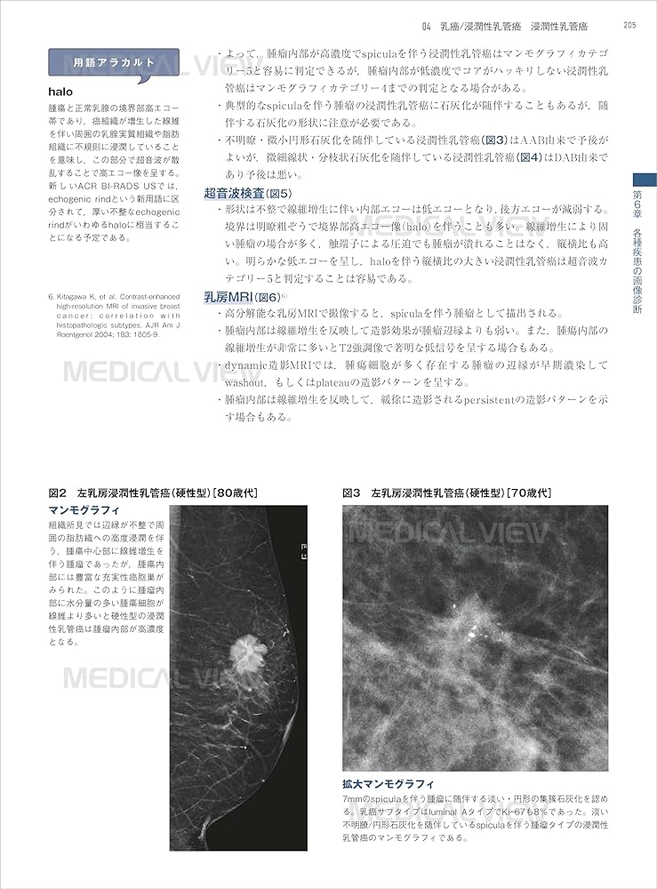 乳房 画像診断の勘ドコロNEO | 角田 博子 |本 | 通販 | Amazon