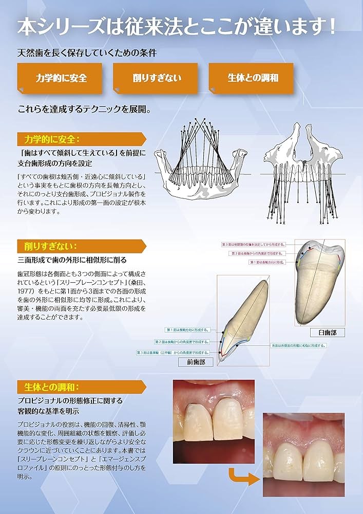 Clinical Provisional Restoration: VISUALプロビジョナル・レスト