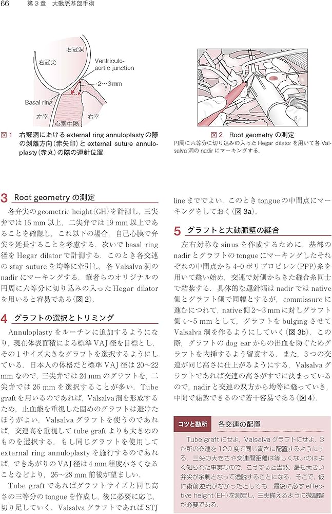 心臓・大動脈外科手術: 基本・コツ・勘所 | 小坂 眞一 |本 | 通販 | Amazon