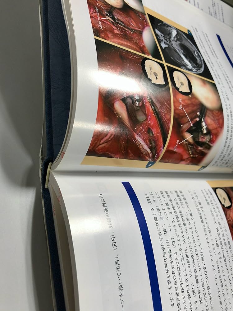 脳神経外科手術の基本手技 | 永田 和哉 |本 | 通販 | Amazon