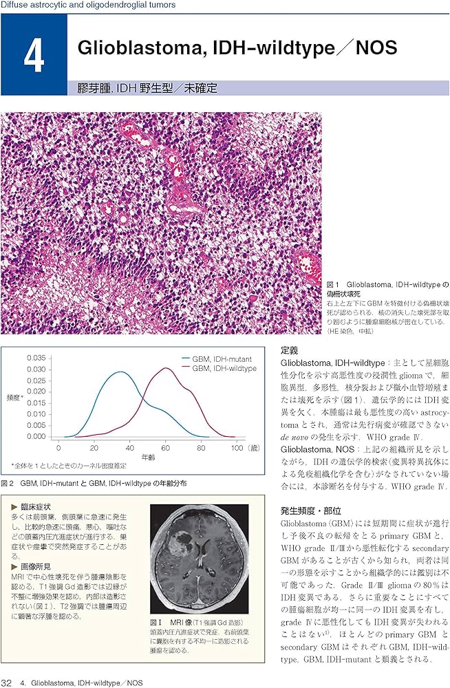 Amazon.co.jp: 脳腫瘍臨床病理カラーアトラス 第4版 : 日本脳腫瘍病理