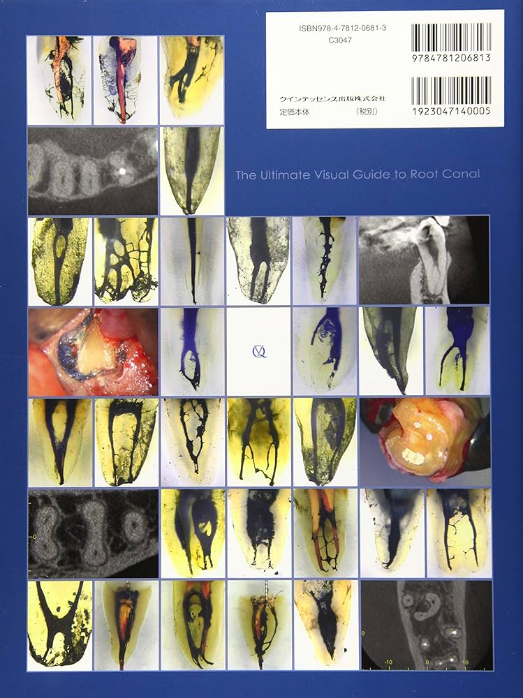 写真とエビデンスで歯種別に学ぶ! 歯内療法に生かす根管解剖 | 吉岡 隆