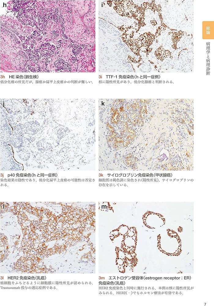 組織病理カラーアトラス[Web付録付] 第3版 | 坂本 穆彦 |本 | 通販