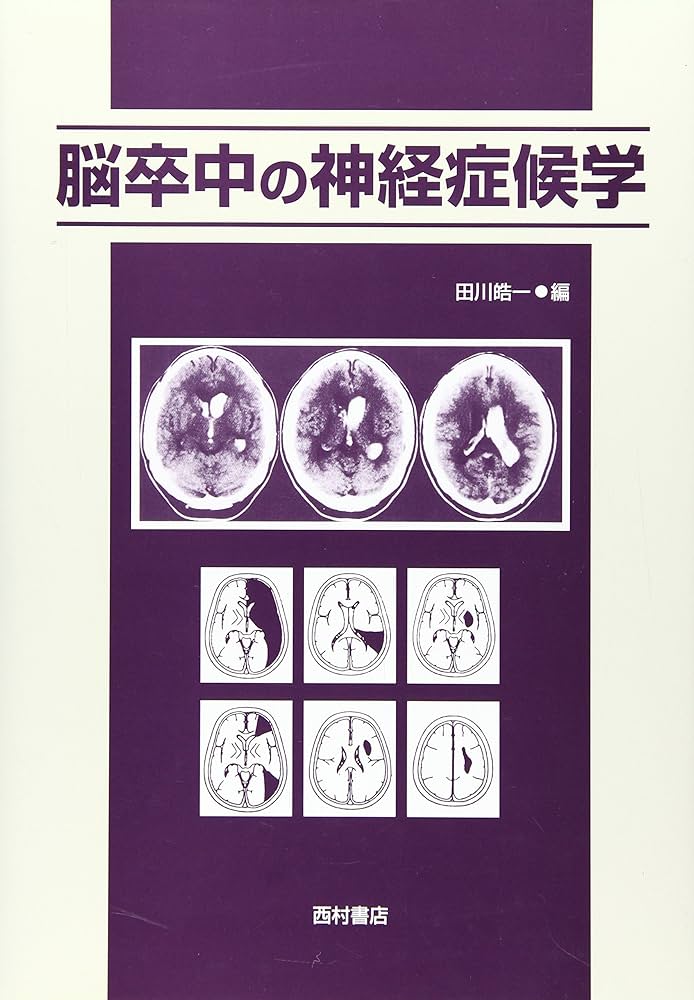 Amazon.co.jp: 脳卒中の神経症候学 : 田川 皓一: 本