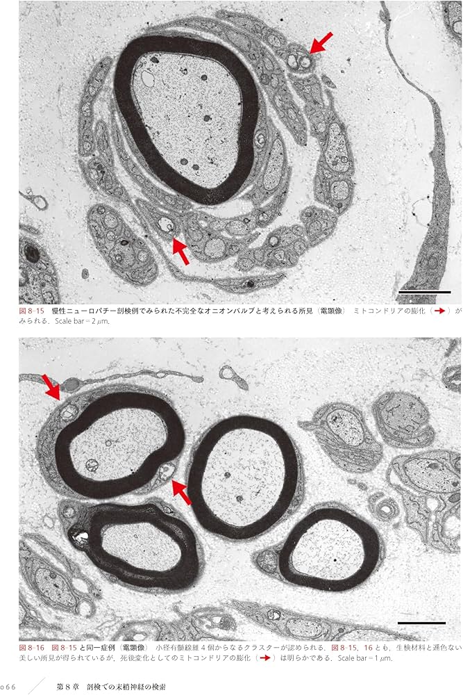 末梢神経病理：どう作り、どう読み、どう臨床に生かすか | 神田隆