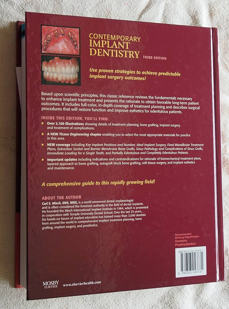 Amazon.co.jp: Contemporary Implant Dentistry : Misch DDS MDS PhD