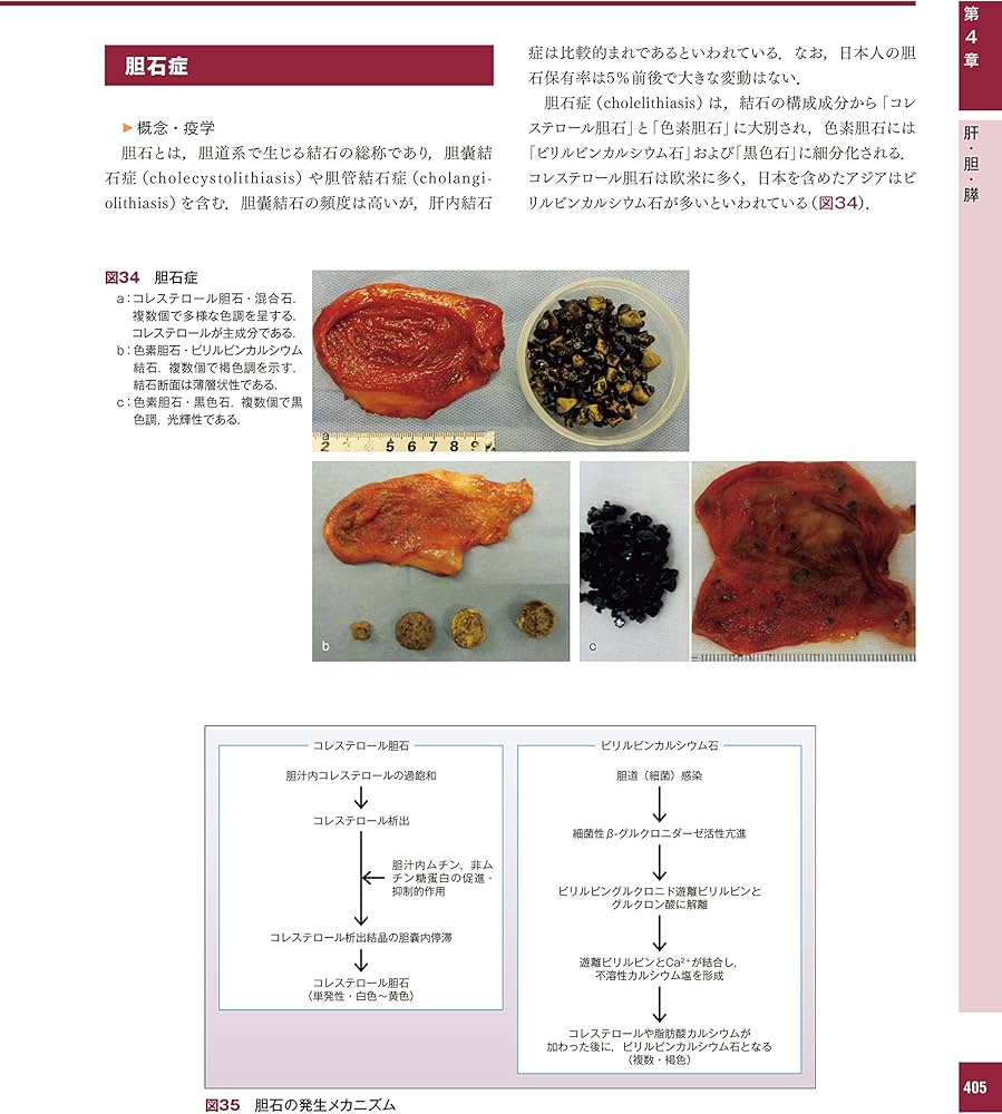 解明 病理学 第3版 病気のメカニズムを解く | 青笹克之, 加藤光保