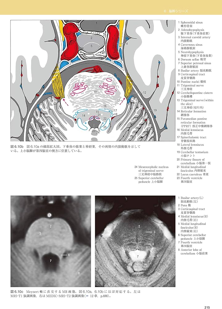 脳の機能解剖と画像診断 第2版 | 眞柳 佳昭 |本 | 通販 | Amazon