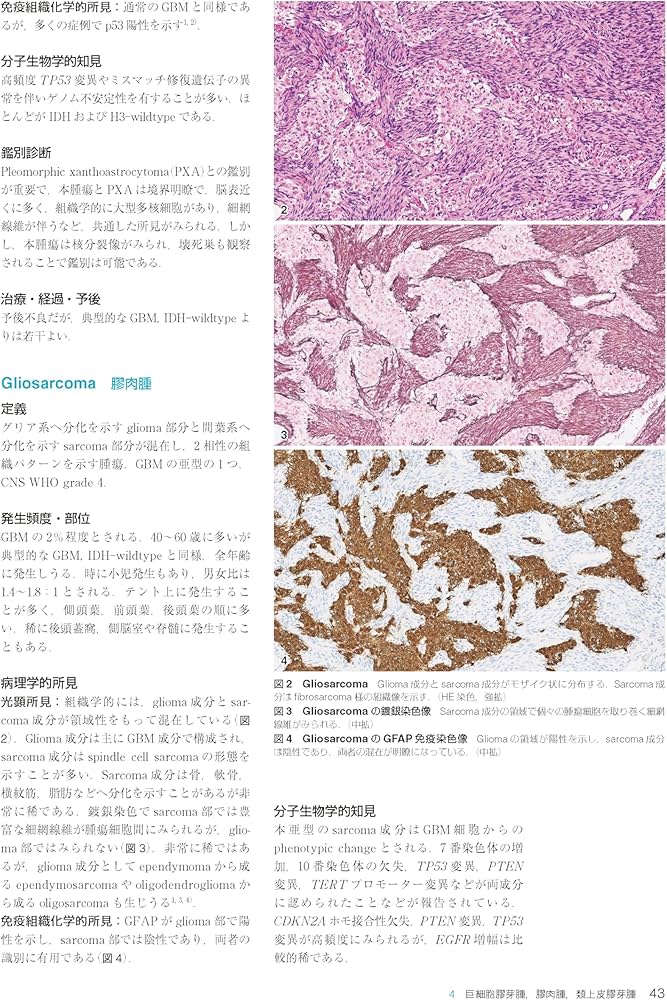 Amazon.co.jp: 脳腫瘍臨床病理カラーアトラス 第5版 : 日本脳腫瘍病理