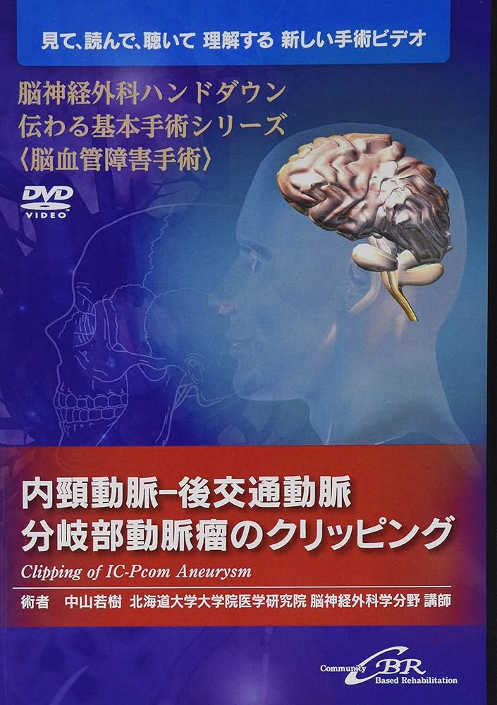 内頸動脈-後交通動脈分岐部動脈瘤のクリッピング―Clipping of IC-Pcom