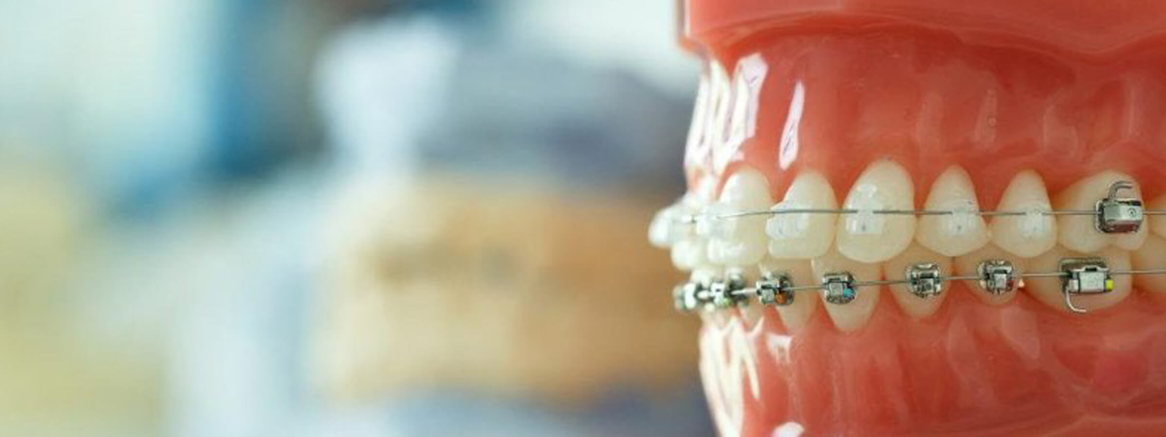 東京都町田市で見た目と機能面を考えた矯正歯科治療｜東京都町田市町田