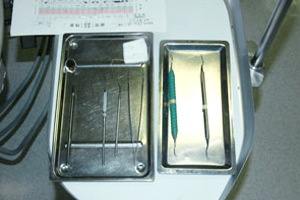 スケーラー・キュレットの滅菌システムと使用ルール | 院内感染対策