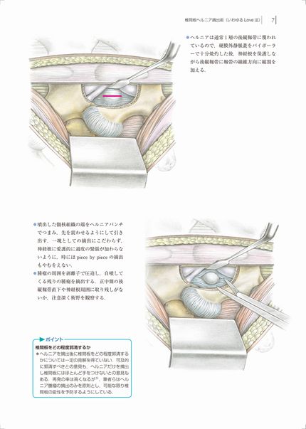整形外科手術イラストレイテッド | 株式会社中山書店
