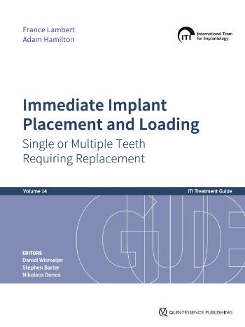 ITI Treatment Guide Volume 3 - Home - ITI