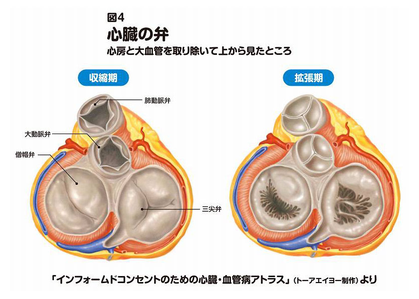 僧帽弁閉鎖不全症とは？原因・症状・検査・治療・手術方法｜ニュー