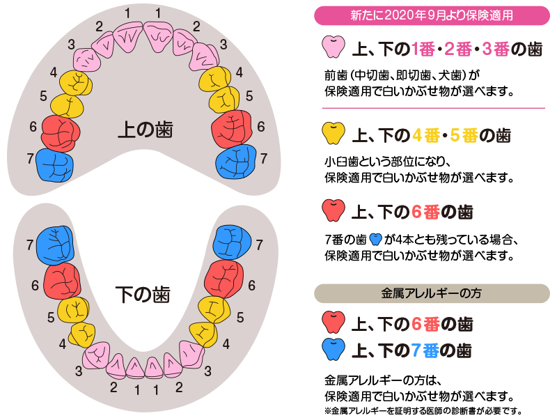 CAD/CAM冠 | 診療案内 | めがね橋駅徒歩5分の歯医者さん｜賑デンタル