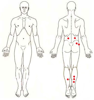 どこに行っても筋筋膜性疼痛症候群と診断してくれない｜にしぼり整形