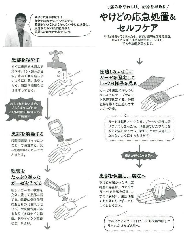 やけど（熱傷）｜大森・大木皮膚科【熱傷専門医が対応致します】