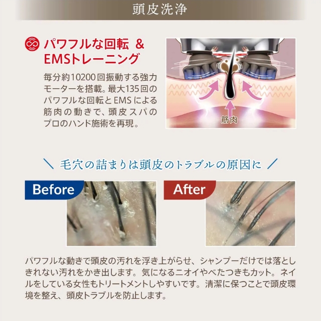 WiLLA（ウィルエー）ゾーガンキン（ZOGANKIN）スカルプ | FIVE WEB