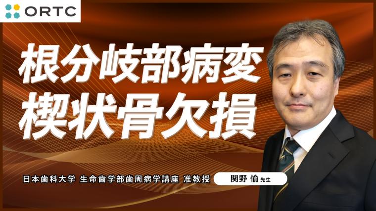 根分岐部病変 楔状骨欠損｜歯科セミナー&歯科動画学習サイト-ORTC