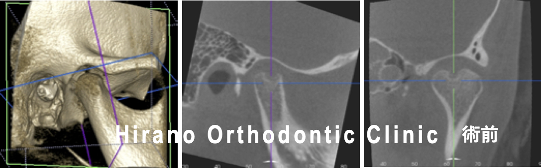 フィシオエナジェティック TMJ2 頭蓋下顎障害と顎関節症 テキスト フィ