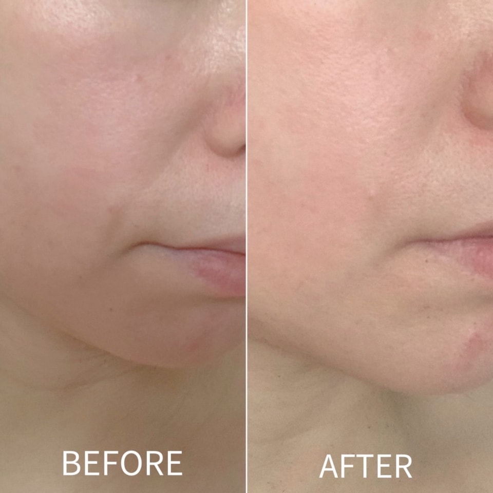 化粧品ではなく、医療行為でもない!? 話題のアンチエイジングコスメ